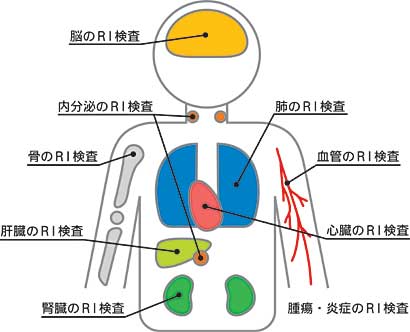 RI検査