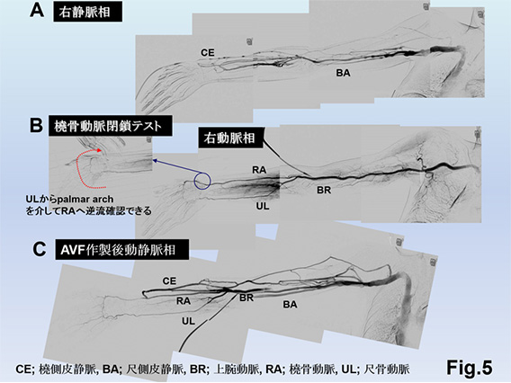 Fig.5