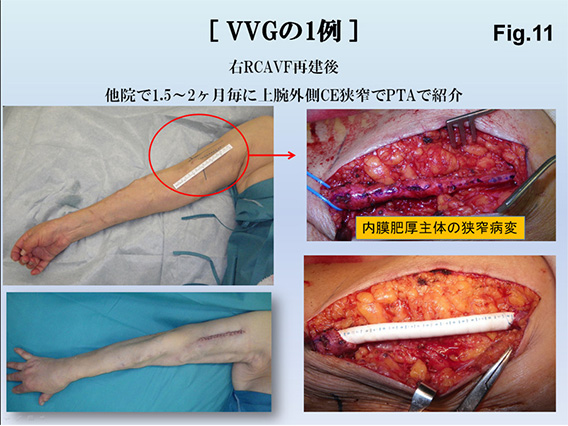 Fig.11