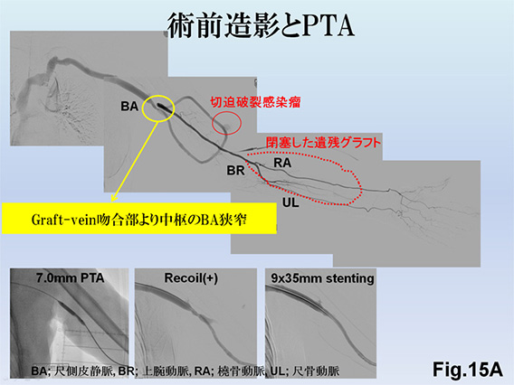 Fig.15A