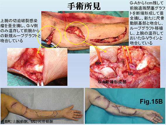 Fig.15B