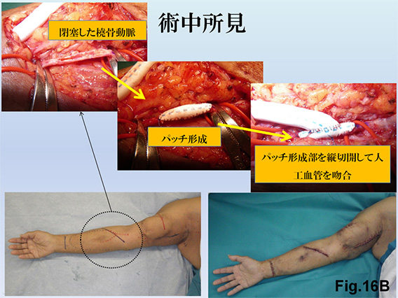 Fig.16B