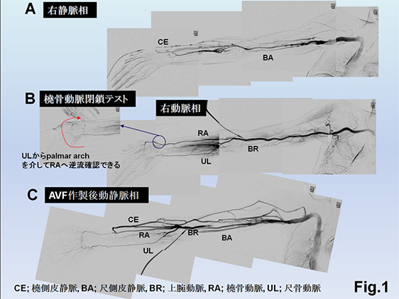 Fig.1