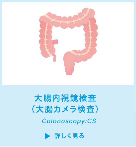 大腸内視鏡検査