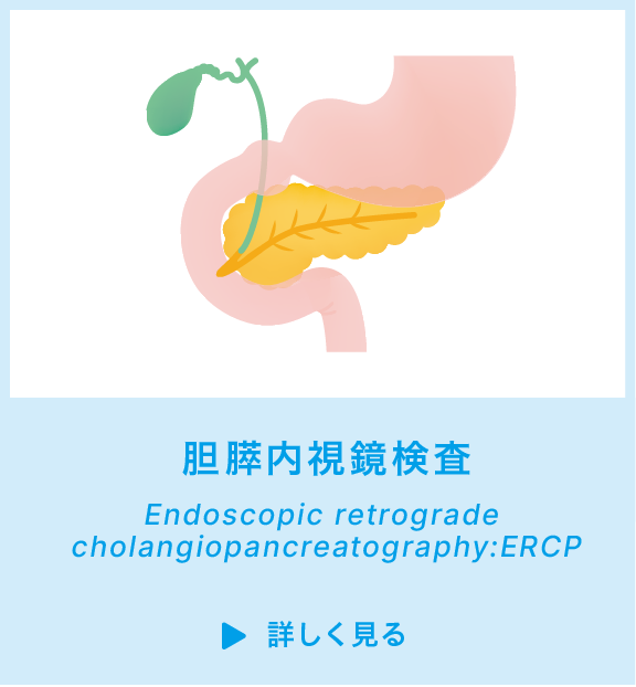 胆膵内視鏡検査